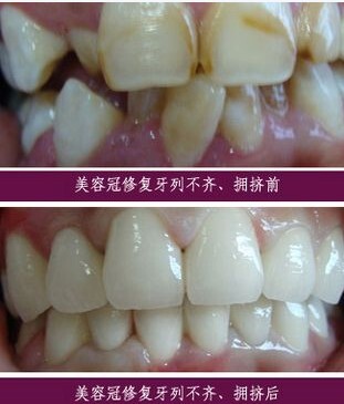 球速体育- 球速体育官方网站- 球速体育APP下载美妆蛋上妆方法