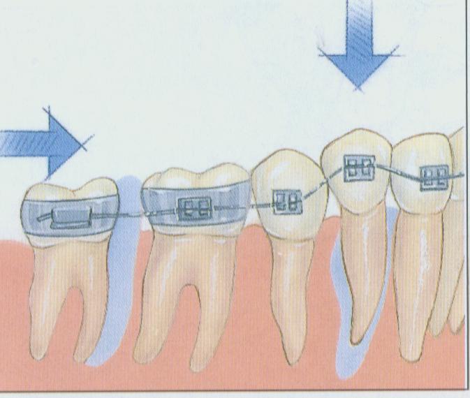 矫正牙齿的最佳年龄是什么时候?