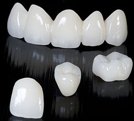 钴铬烤瓷牙的费用多少