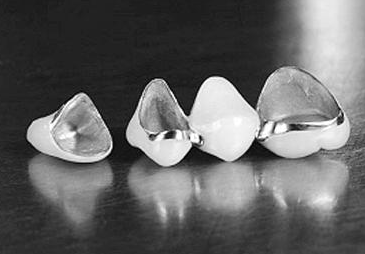 什么烤瓷牙最好