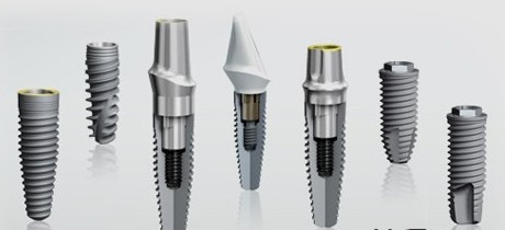 奥齿泰种植牙需要多少钱