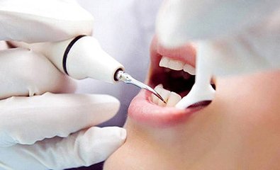 福州种植牙一颗大约多少钱